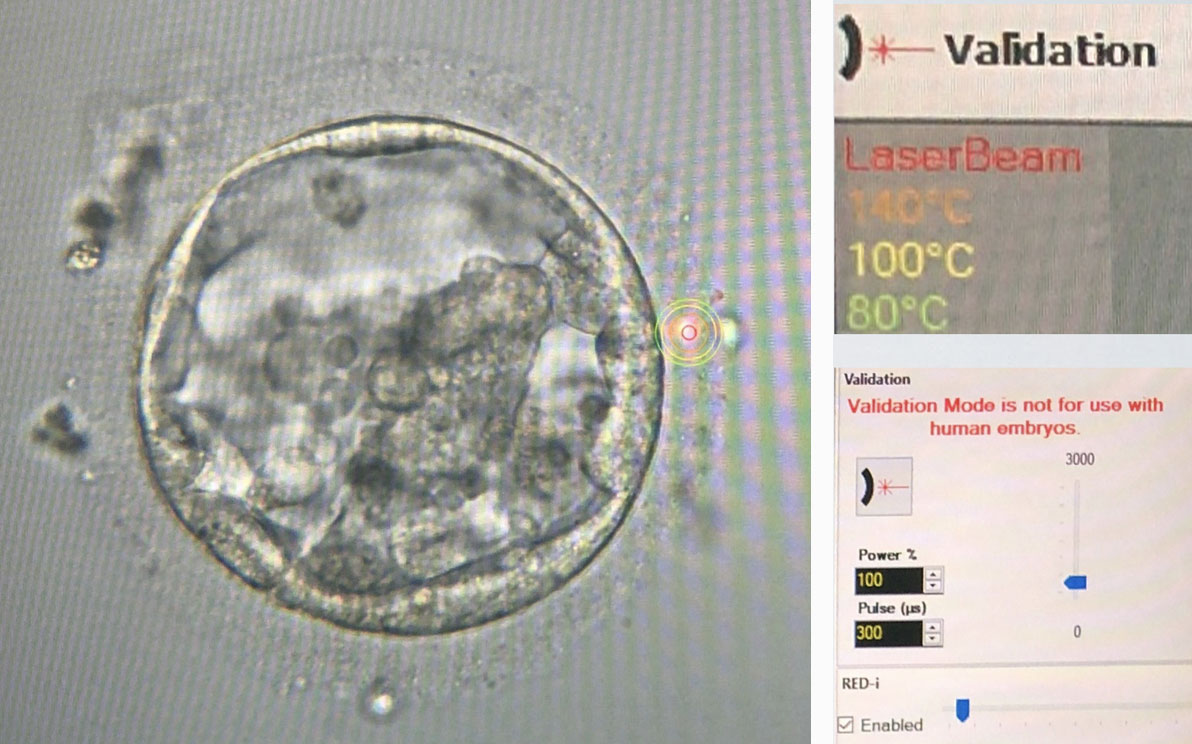 Laser-assisted Hatching(LAH)